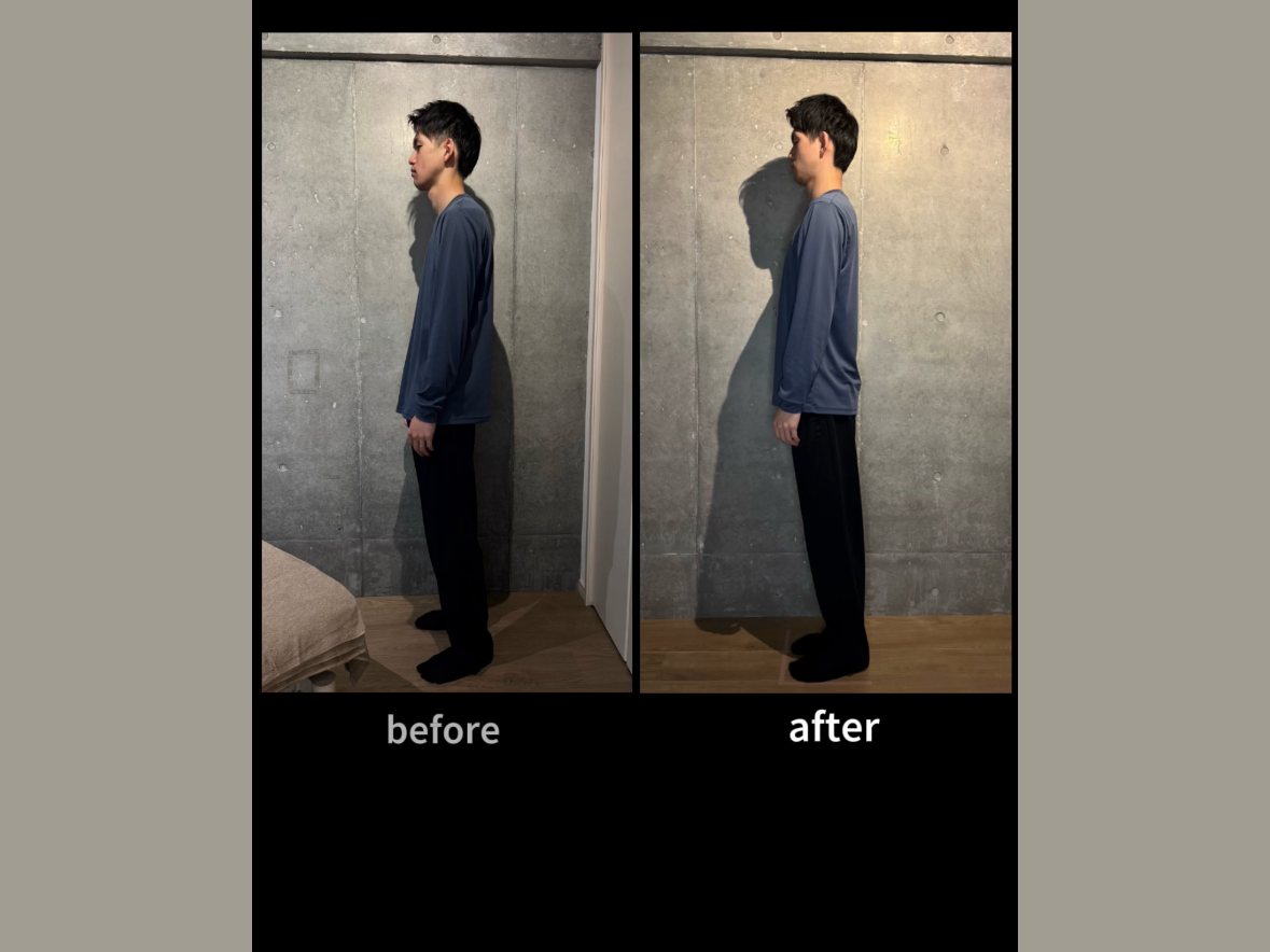 姿勢の変化 before / after